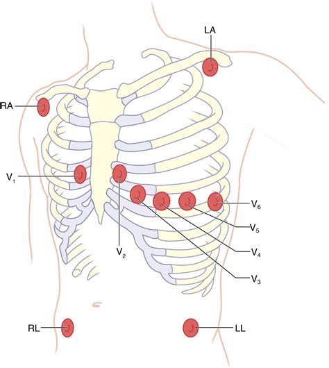 Cardiovascular Monitoring - Clinical Tree