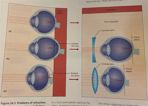 Image result for Refraction Physics 2 Hard Problems
