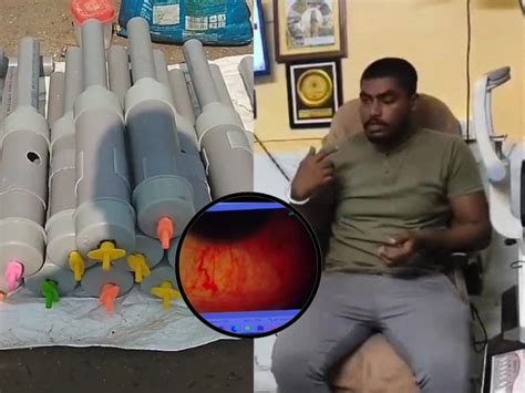 malda youth suffer eye injuries in carbide blast doctors warn of ...