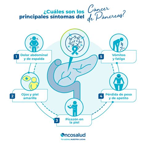 ¿Cuáles son las causas del Cáncer de Páncreas?