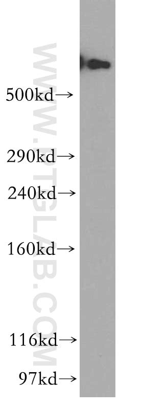 DYNC1H1 antibody (12345-1-AP) | Proteintech