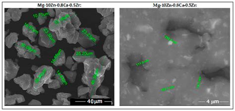 Biodegradable Magnesium Alloys for Personalised Temporary Implants