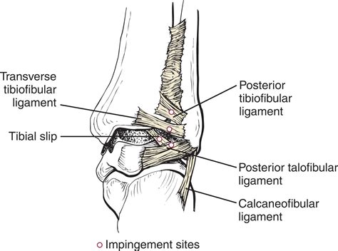 Arthroscopy of the Foot and Ankle - Clinical Tree