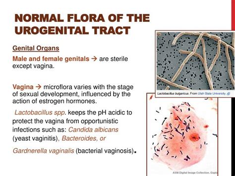 Mixed Urogenital Flora In Urine Means at Roxanne Bell blog
