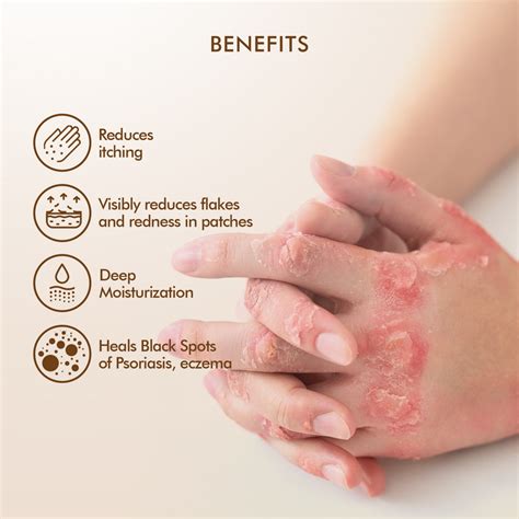 Vedicderm Ultimate Psoriasis Care Bundle – VEDICDERM