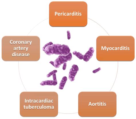 Cardiovascular Involvement in Tuberculosis: From Pathophysiology to ...