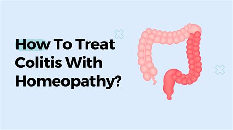 How To Treat Colitis With Homeopathy?