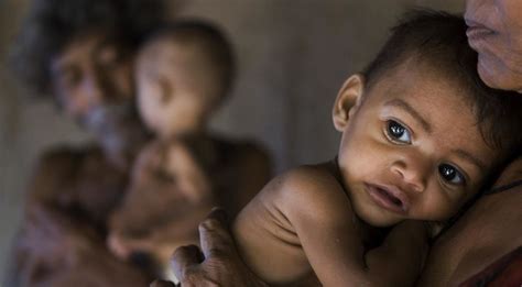 Is Malnutrition Stunting Young India's Growth, Literally? | SabrangIndia