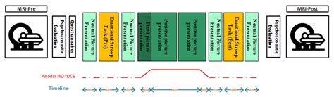 Down-Regulation of Tinnitus Negative Valence via Concurrent HD-tDCS and ...