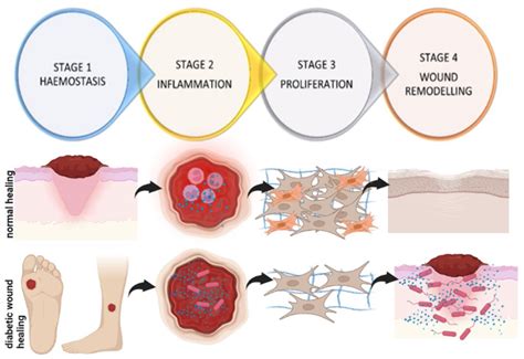 The Effects of Blue Light on Human Fibroblasts and Diabetic Wound Healing