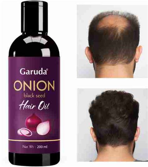 Garuda Red Onion Hair Oil for Hair Regrowth & Hairfall Control – 200ml ...