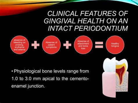 Image result for Classification Periodontitis