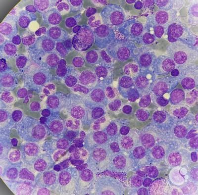 Plasma Cell Structure 的图像结果