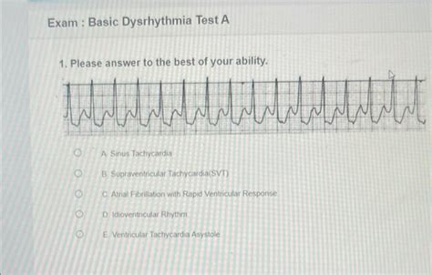 Basic Dysrhythmia Practice Test 的图像结果