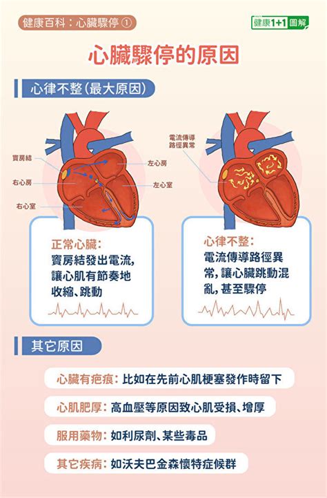 心脏骤停有3症状 2招急救防猝死！急救方法全图解 | 心跳 | 心律不整 | CPR | 新唐人中文电视台在线