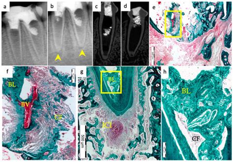 Materials | Special Issue : Advances in Biomaterials for Endodontics ...