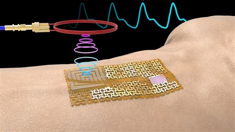 Wearable Sensor 的图像结果