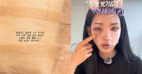 Choi Jun-hee reports severe conjunctivitis after follow-up eye surgery ...