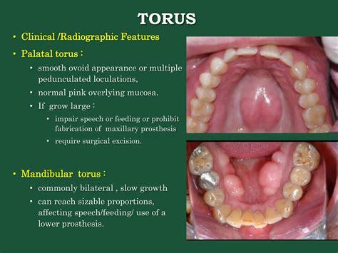 swelling_of_jaw_and_surgery_of_mandible_my_ppt.pptx