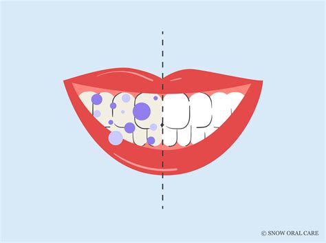 Image result for Does Purple Toothpaste Work