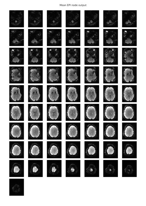 What Does Medical Term Epi- Mean at Susan Burke blog
