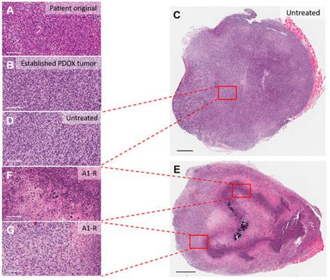 Efficacy of Tumor-Targeting Salmonella typhimurium A1-R against ...