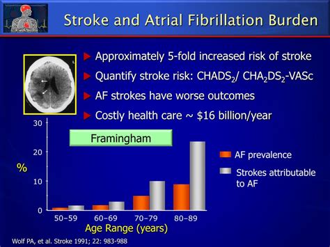 Atrial Fibrillation 的图像结果