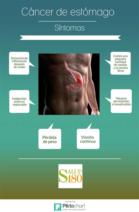 Como Es El Cancer De Estomago Sintomas at Archie Cowley blog