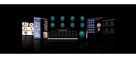 Xeleris 4 DR | GE HealthCare (India)