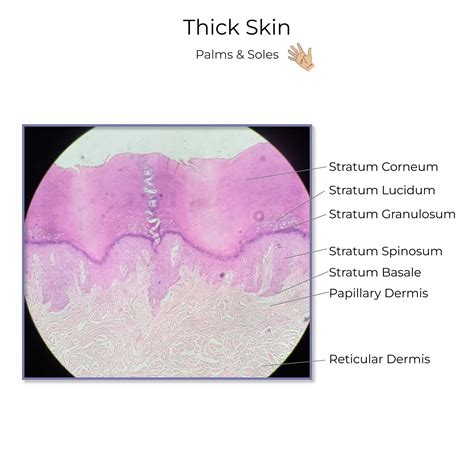 Reticular Layer Reticular Dermis Wikidata