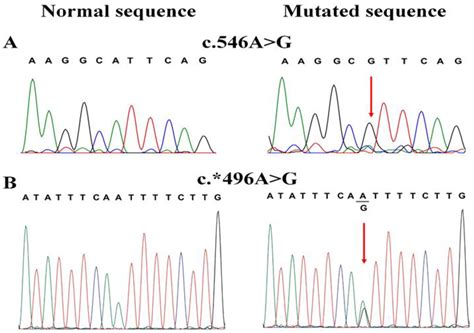 Rare Variants Residing in Novel Cis-Acting Element in Visual System Homeobox 1 and Their ...