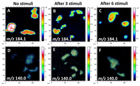 Mass Spectrometric Imaging of Plasma Membrane Lipid Alteration ...