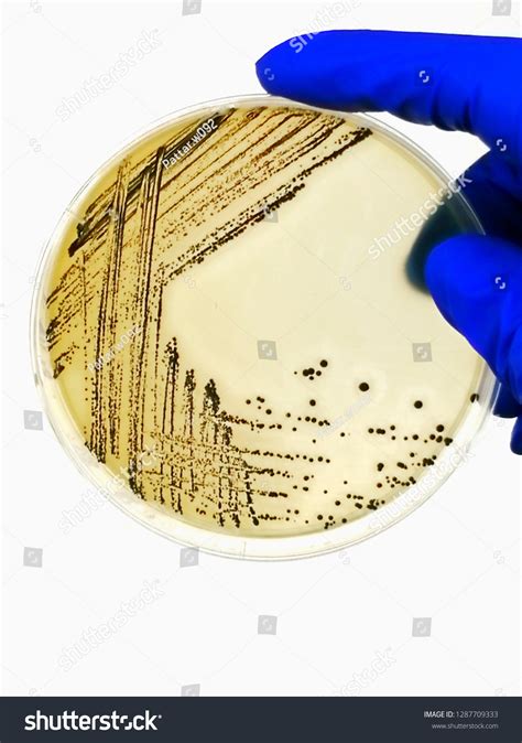 Staphylococcus Aureus Petri Dish: Over 830 Royalty-Free Licensable ...
