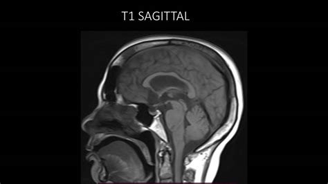 BIR Quiz of the Week