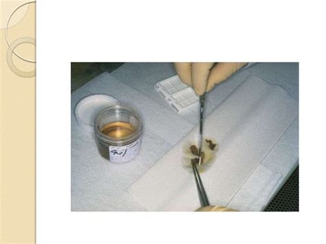 Image result for Mutilate Tissue Sample