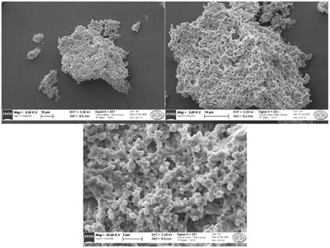Chemical and Physical Characterisation of Macroaggregated Human Serum ...