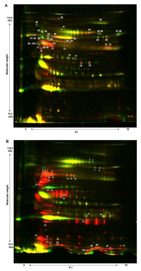 Proteomic Analysis of Human Serum from Patients with Chronic Kidney Disease