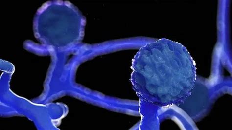 Black fungus: 8848 patients across India, 36 in Kerala - INDIA ...