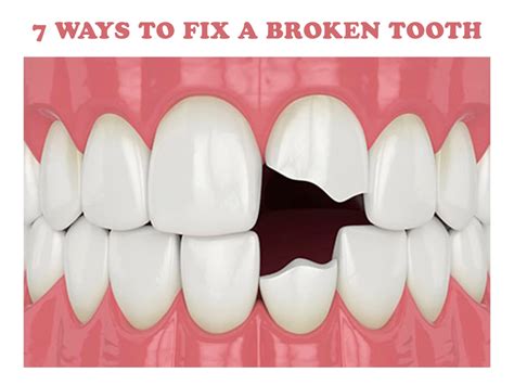 Image result for Broken Tooth