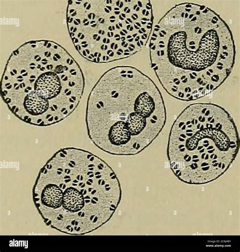What Does Pimple Pus Look Like Under A Microscope at Dakota Bunce blog