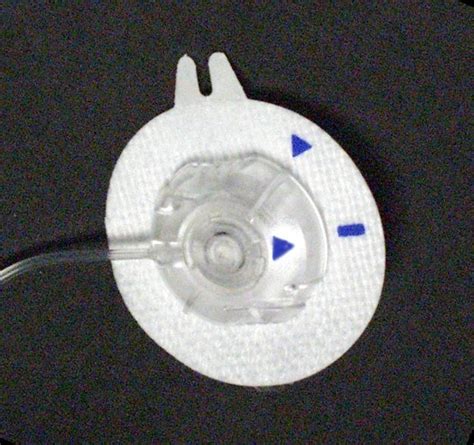 Image result for Minimed Quick Set Problems