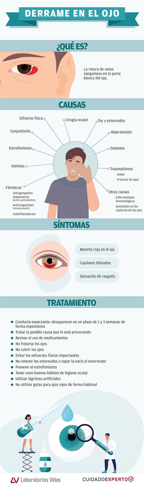 Cuidado de los ojos : Laboratorios Viñas. Ciencia para tu vida.