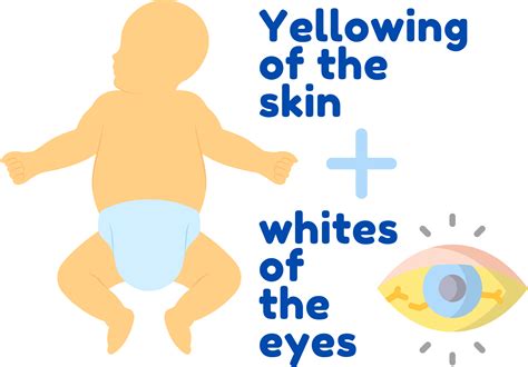 Jaundice Skin Test Baby