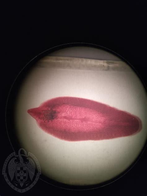 Fasciola hepatica