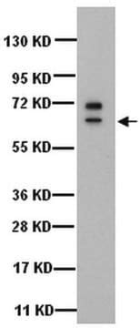 Anti-Cytokeratin 5 Antibody, 6, clone D5/16B4 clone D5/16B4, Chemicon ...