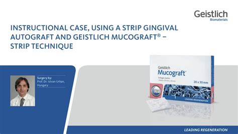 Downloads Dental Professionals - Geistlich Pharma AG