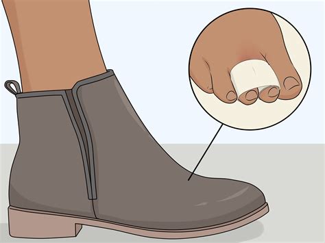 How to Buddy Tape an Injured Toe: 7 Steps (with Pictures)