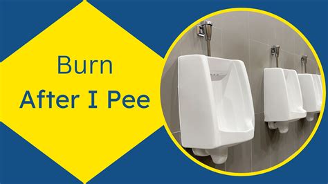 Burn After I Pee : What It Means and How to Deal With It - Zorg Health