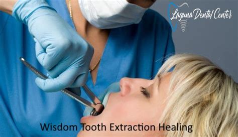Image result for Recovery From Wisdom Tooth Extraction