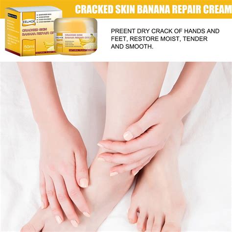 Buy HIABIO Cracked Banana Repair Cream for Remove Dead Skin Soften ...